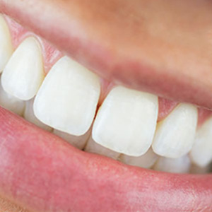 Buffalo Immediate Dentures at The Smile Center